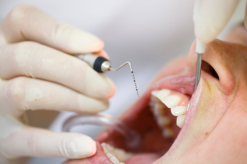 Clínica dental Leioa - tratamientos